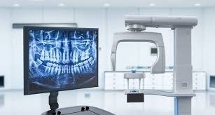 Digital X-Ray